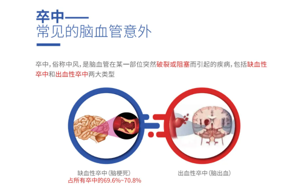 脑卒中科普160.png