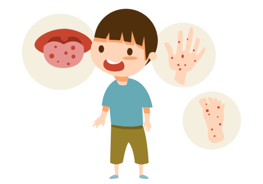 传染病防控 别把手足口当“普通疹子”！195.png